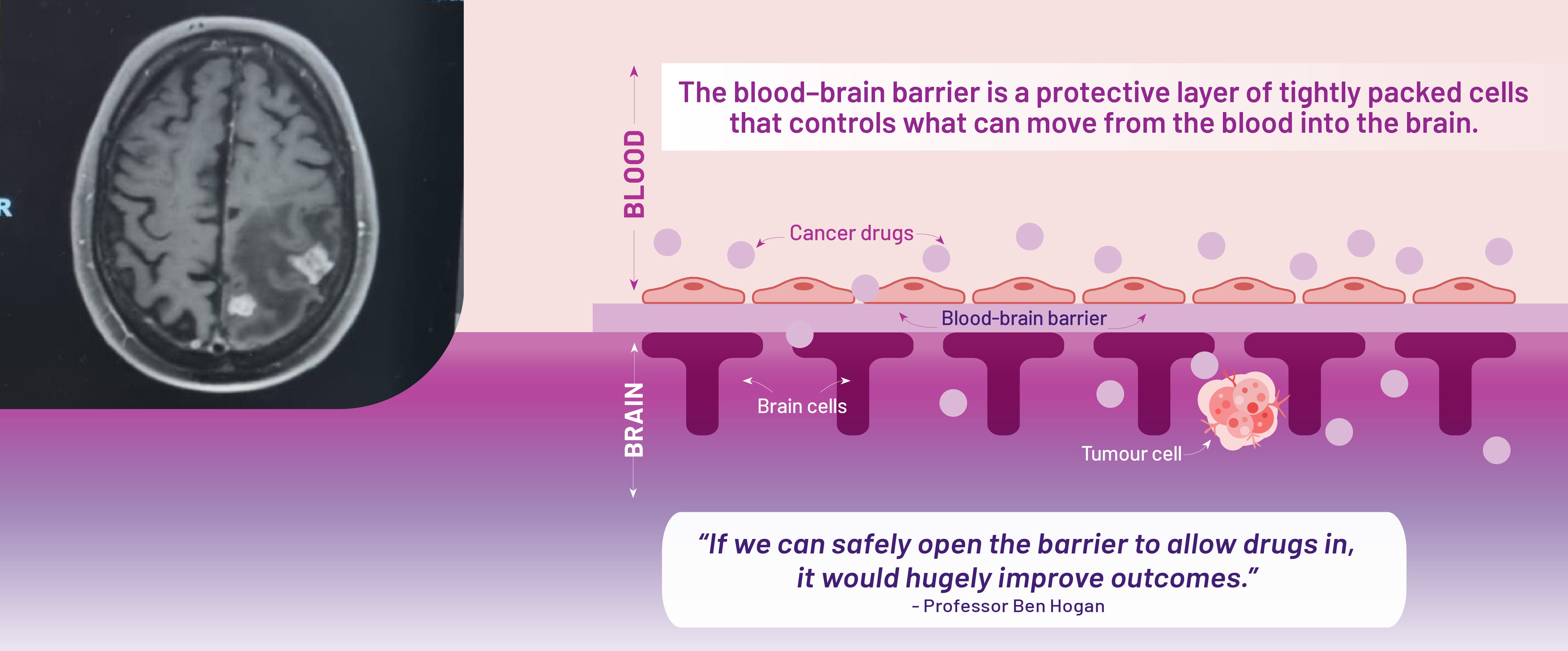 Brain Barrier Illustration SPRING26 01 1
